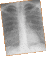 X-ray image